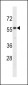 IL17RE Antibody(N-term)